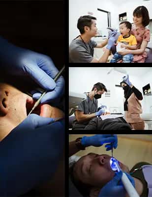 Dental Services Offered at One Smile Dental Clinic