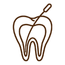 Root Canal Treatment